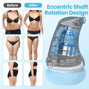 Before and after body slimming results with massage device and eccentric shaft rotation design