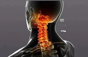 3D illustration of human neck pain with highlighted cervical spine and vertebrae